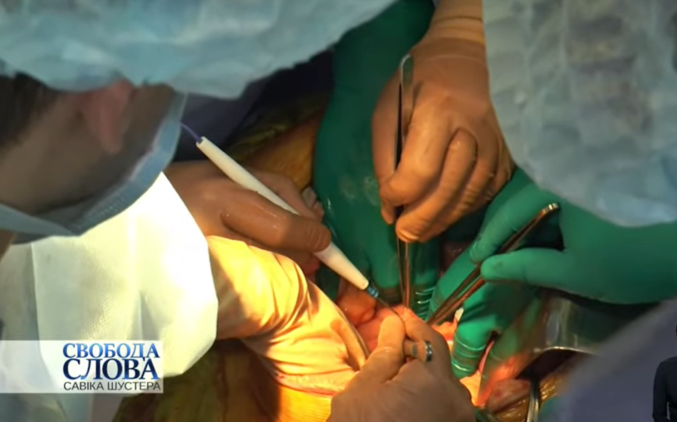 Відео унікальної операції з пересадки органів у Запоріжжі показали в ефірі