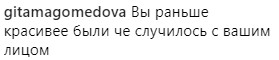 &quot;Що сталося з вашим обличчям?&quot;: Лорак налякала фанатів зовнішнім виглядом