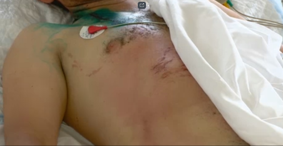 Шах і мат, атеїсти: хрестик врятував чоловіка від смерті при ударі блискавки (фото)