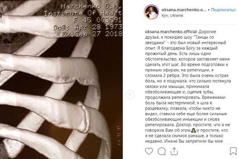 "Покидаю шоу": Оксана Марченко серьезно травмировалась на Танцах со звездами