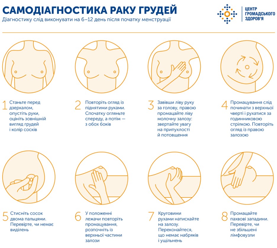 В Украине каждую неделю более 100 человек умирает от рака молочной железы, - Минздрав
