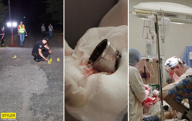 Вибух на дитячому майданчику під Дніпром: з'явилася нова інформація про покалічених дітей