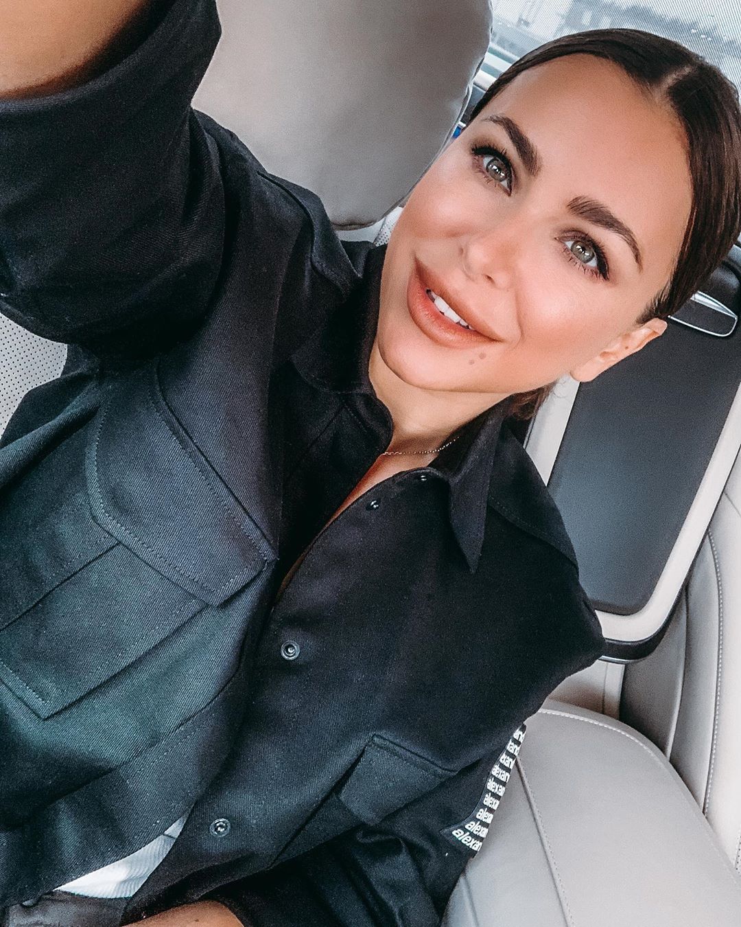 Пора в музей воскових фігур: Ані Лорак запідозрили в операції на обличчі