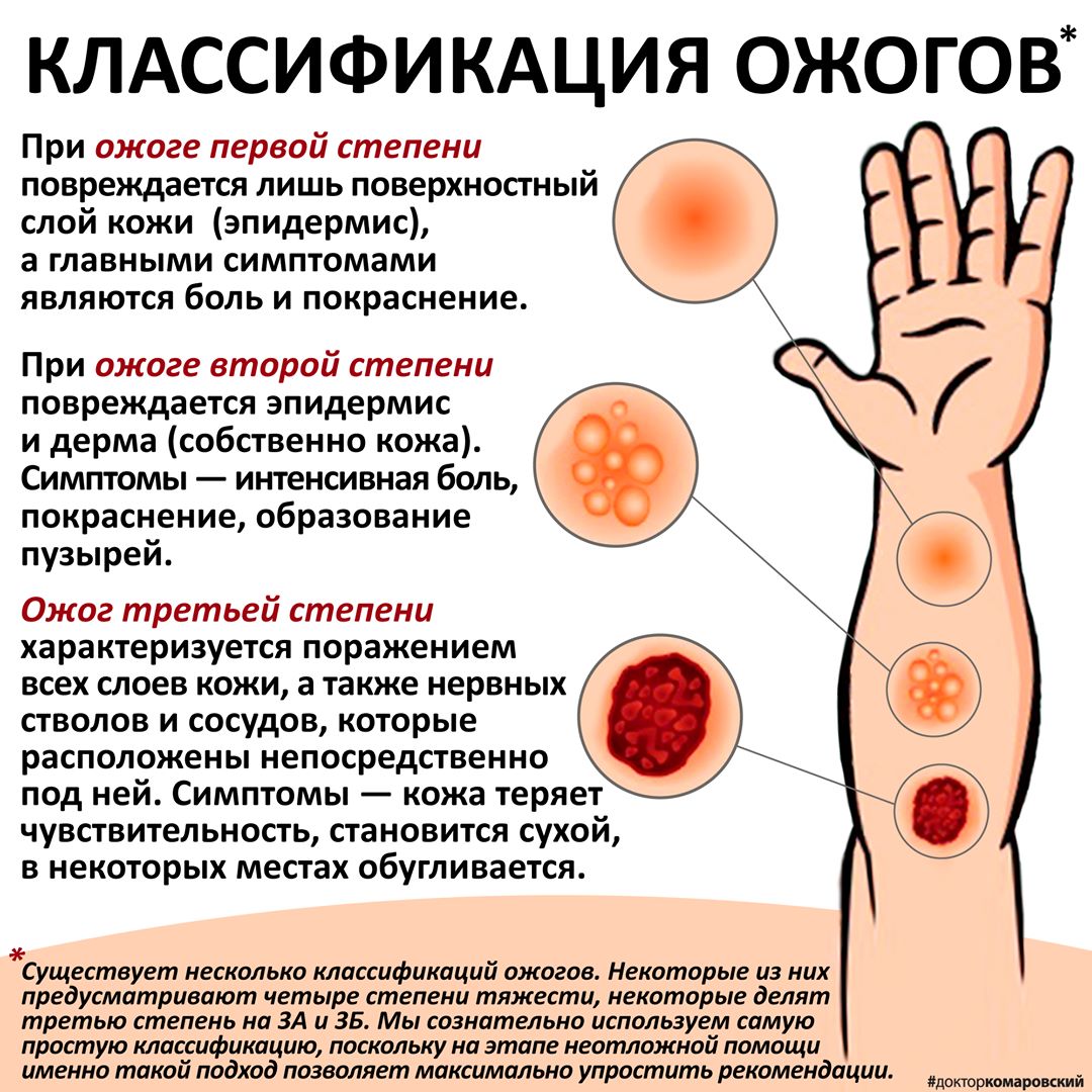 Существует несколько классификаций: Комаровский дал важную информацию об ожогах