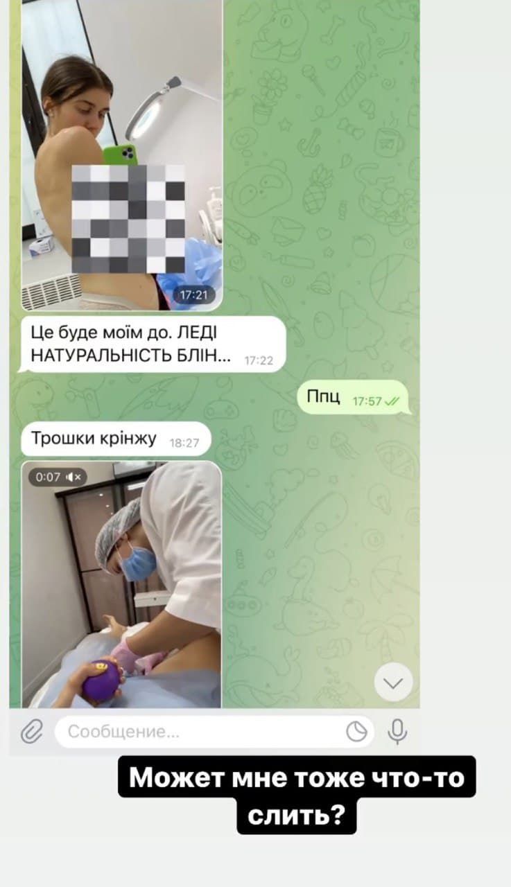 Анна Тринчер рассказала, почему опубликовала откровенные фото Jerry Heil