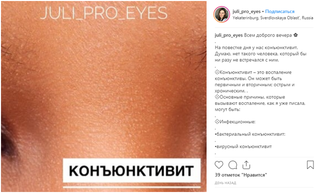 Офтальмолог розповіла, як правильно лiкувати кон'юнктивіт правильно