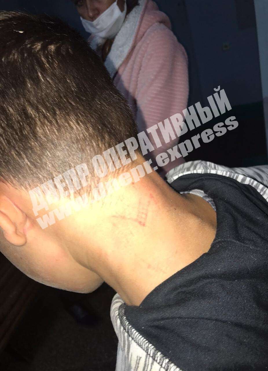 Душили і били по голові: під Дніпром роми напали на 12-річну дитину
