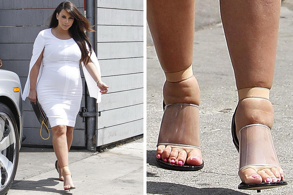 Вернуться в строй: как менялись звезды во время и после беременности (фото)