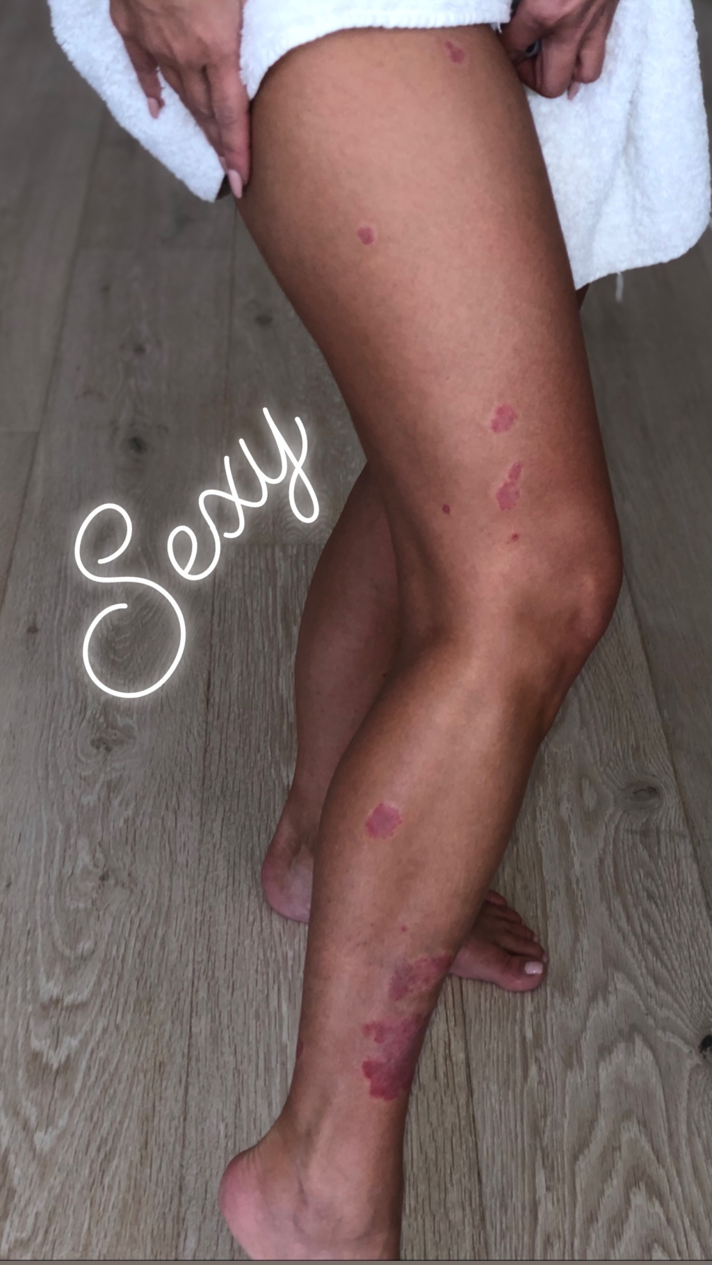 Смелая и откровенная: Ким Кардашьян не побоялась показать недостатки кожи (фото)