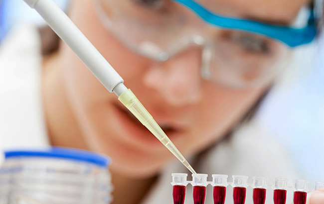 Спалах гепатиту А в Україні: як не стати жертвою небезпечного вірусу