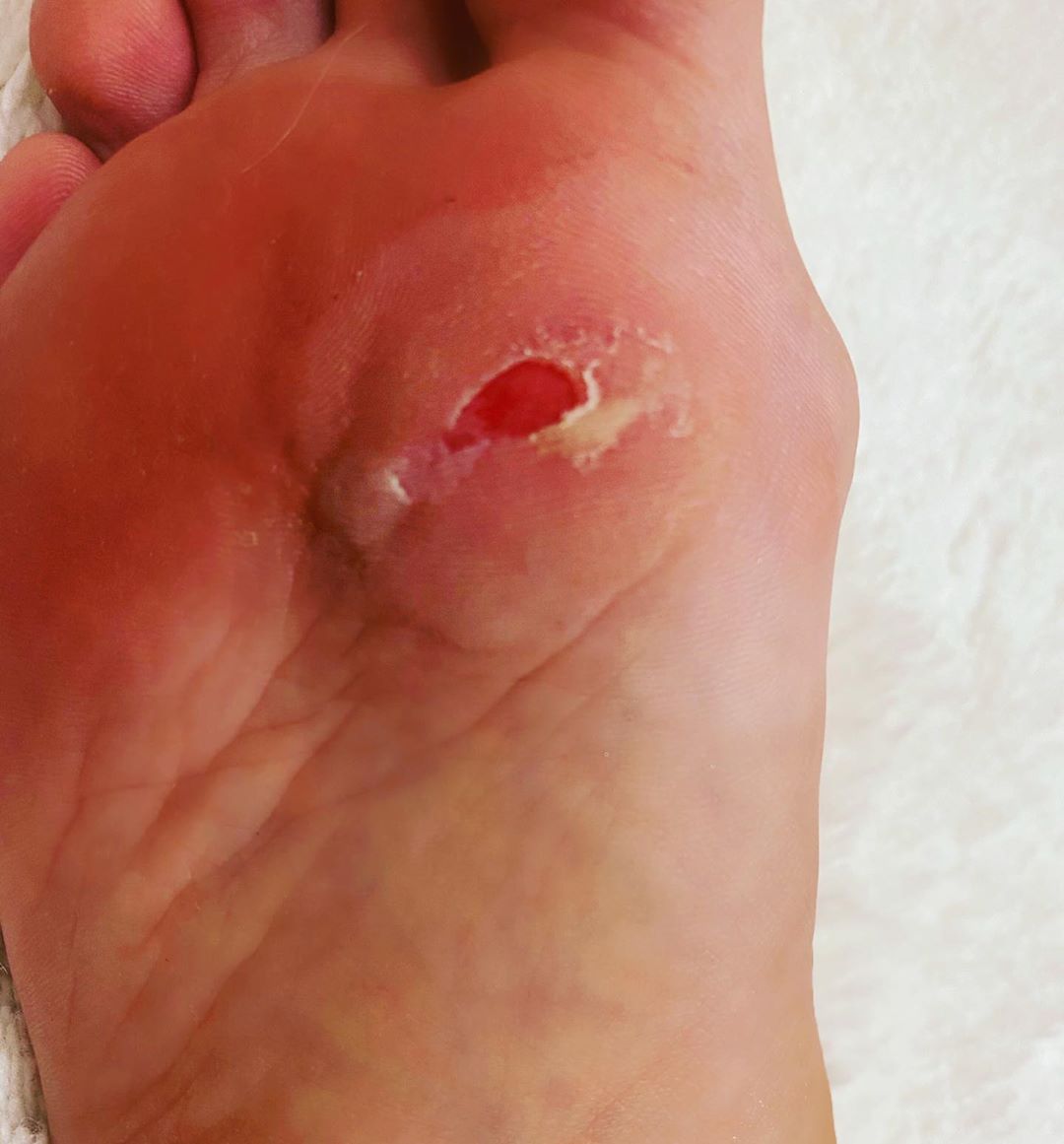 Пролежала пару часов на полу: Лобода пожаловалась на трудности профессии артиста