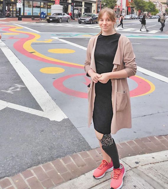 Українка, яка втратила ногу в АТО, біжить марафони: історія незламного духу