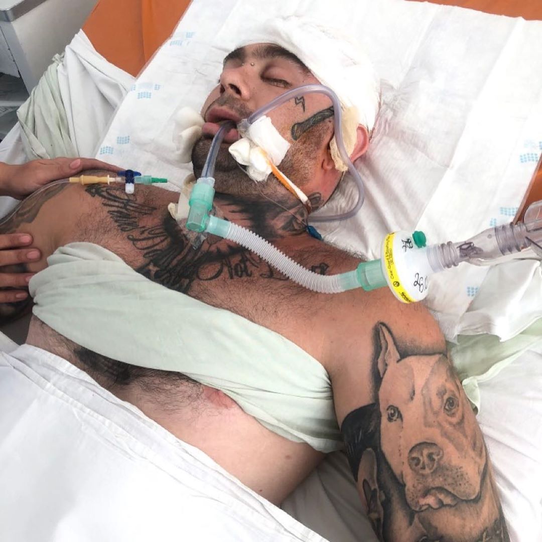 Потрібна допомога: відомий український музикант потрапив у ДТП