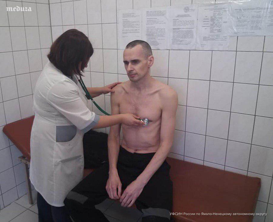 З'явилося фото обстеження Сенцова в російській лікарні