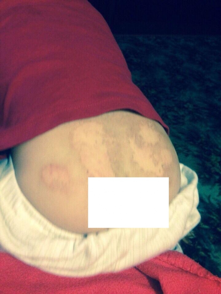 Под Запорожьем медсестра детсада прописала ребенку мазь для котов: последствия лечили долго