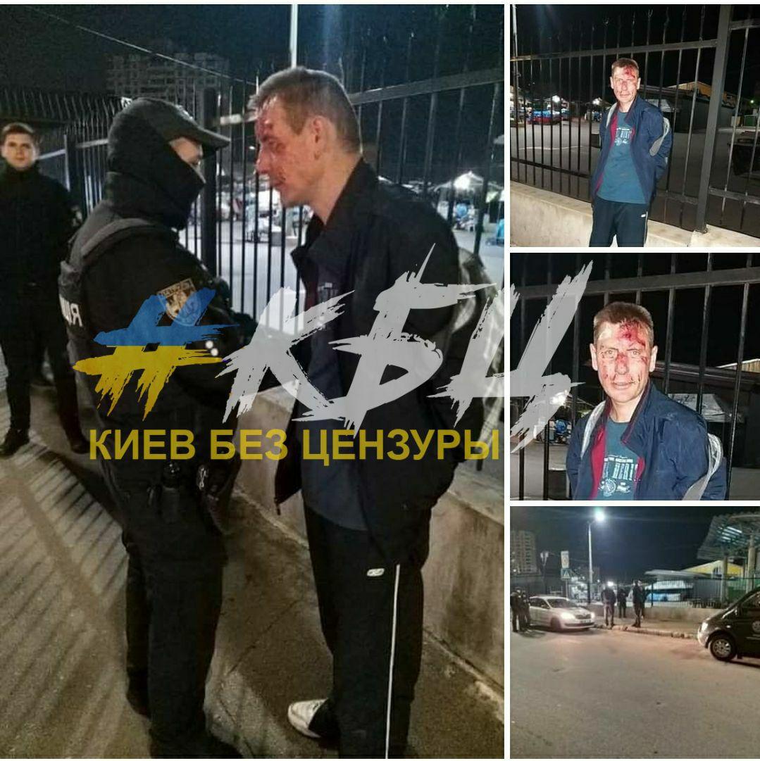 У Києві пенсіонерка жорстко покарала злодія: &quot;трошки&quot; побитий (фото)