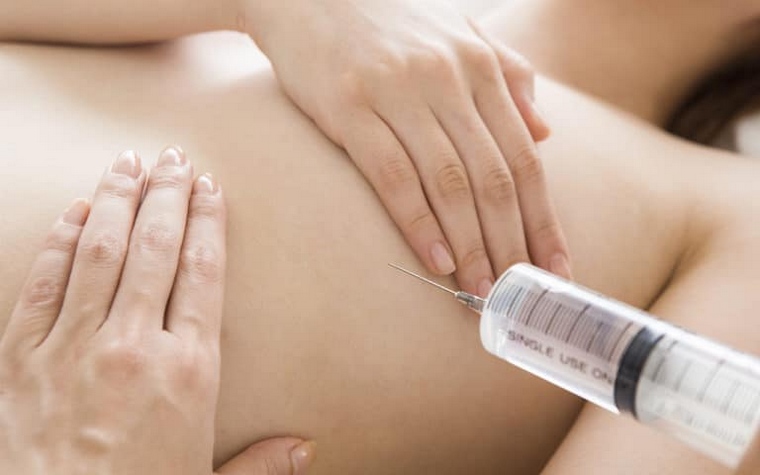 Современные способы увеличения груди и надо ли рисковать?