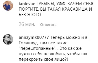 Пора в музей воскових фігур: Ані Лорак запідозрили в операції на обличчі