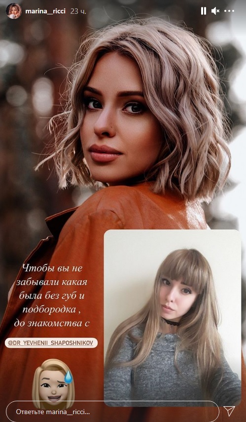 Известная украинская блогер показала, как выглядела до пластики