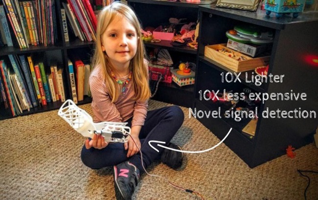 Програміст надрукував на 3D-принтері реабілітаційний біонічний ортез для своєї дочки