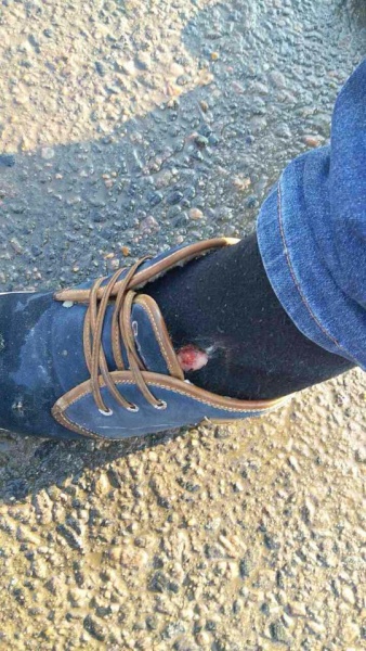 В Одесі між ветераном АТО і екс-зампрокурором області сталася перестрілка