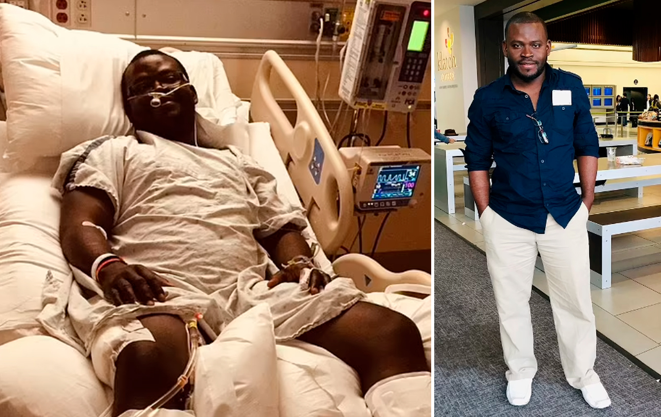 Чоловік зламав собі обидві ноги, щоб сходити на побачення (фото)