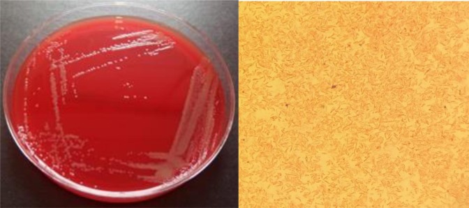 Previously unknown infectious bacterium identifiied: What's known