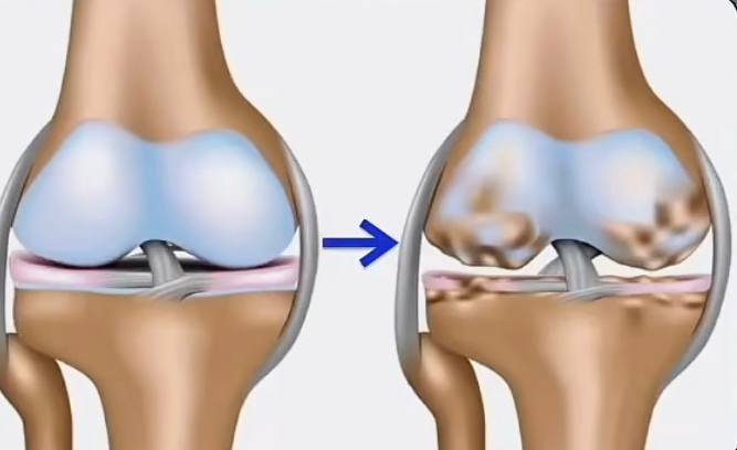 Тренер показала, как нельзя сидеть за столом: фото вредных поз