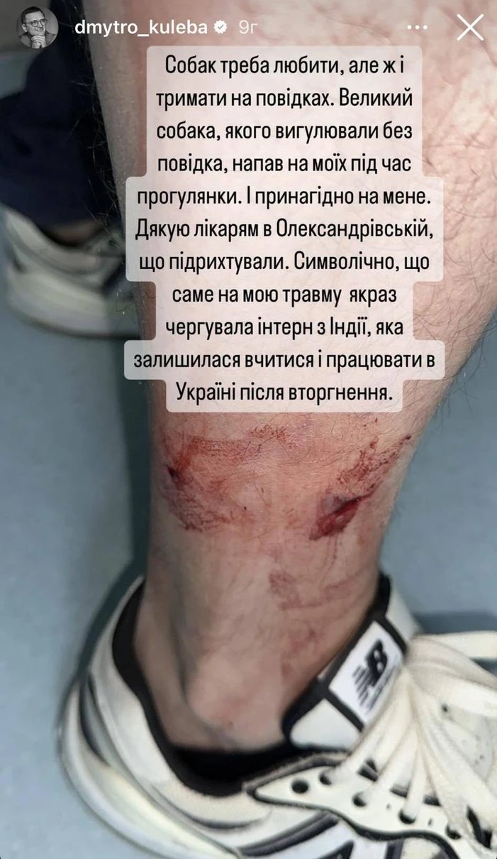 Дмитро Кулеба потрапив у лікарню після прогулянки з собаками: що трапилося (фото)