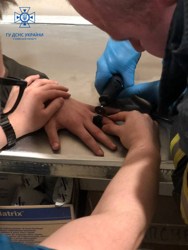 Под Киевом парень не мог снять кольцо от фонарика с пальца: видео спасения