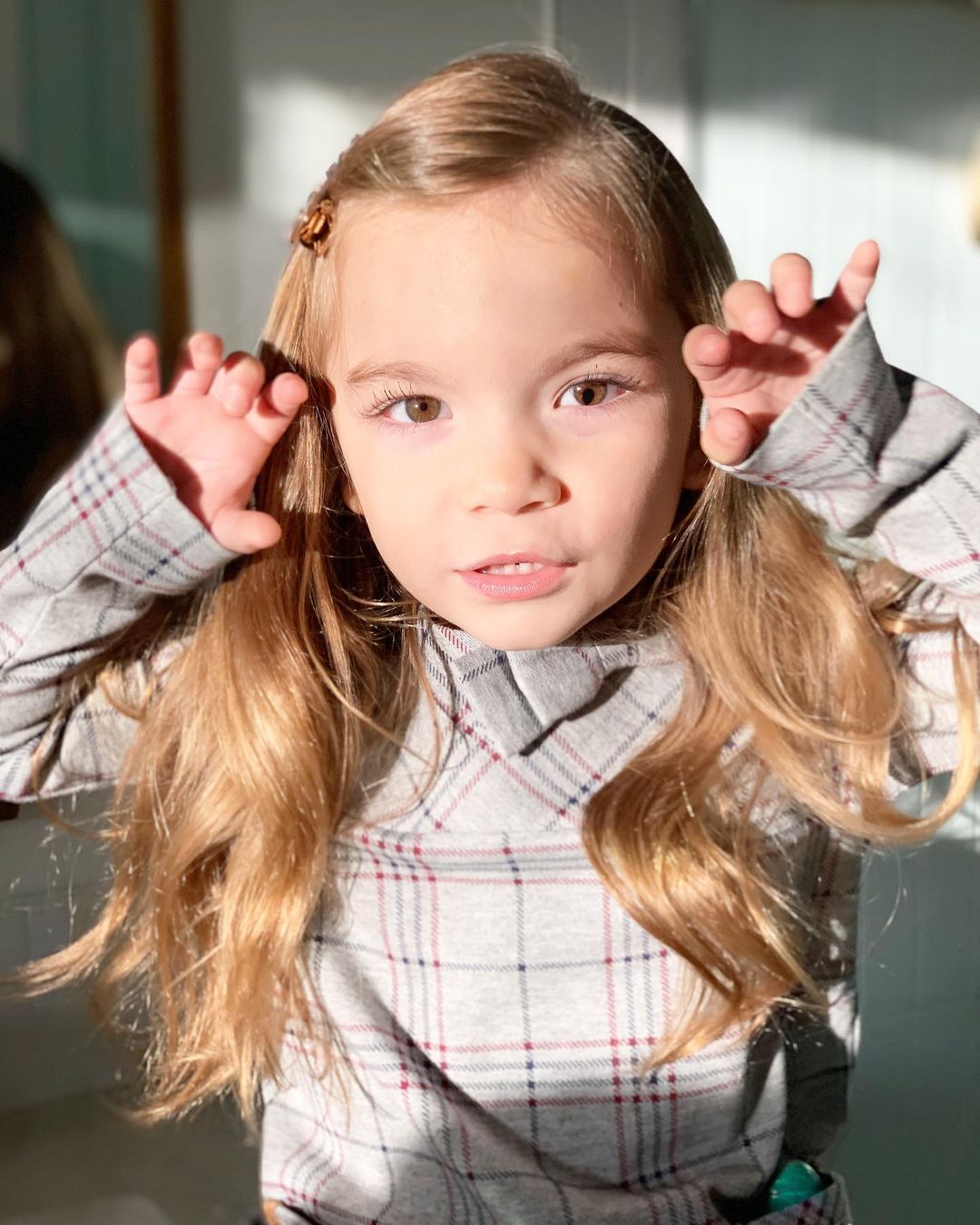 Вот как выглядят люди с генетическим дефектом глаз, который делает взгляд &quot;змеиным&quot;