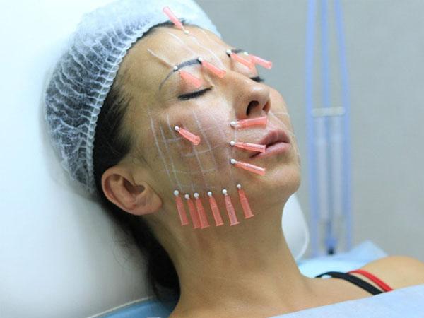 Предупреждение для украинок: топ-5 косметических процедур, которых следует избегать