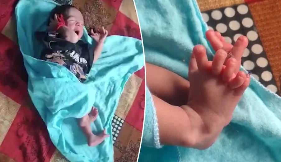 Дівчинка народилася на світ із 26 пальцями: батьки вважають це божественним (фото)