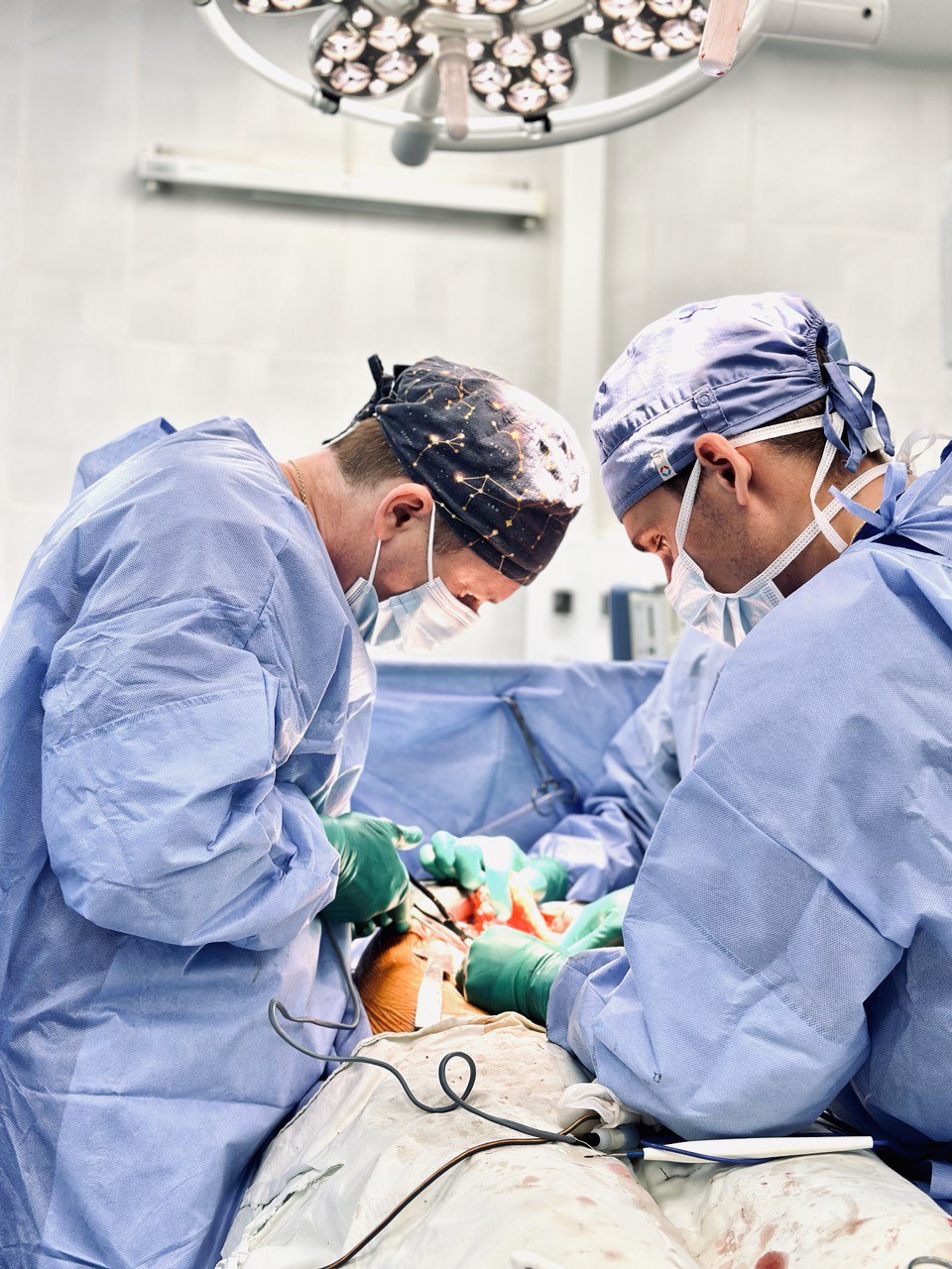 Довжина 20 сантиметрів: у Києві в жінки виявили небезпечне утворення, яке стискало органи