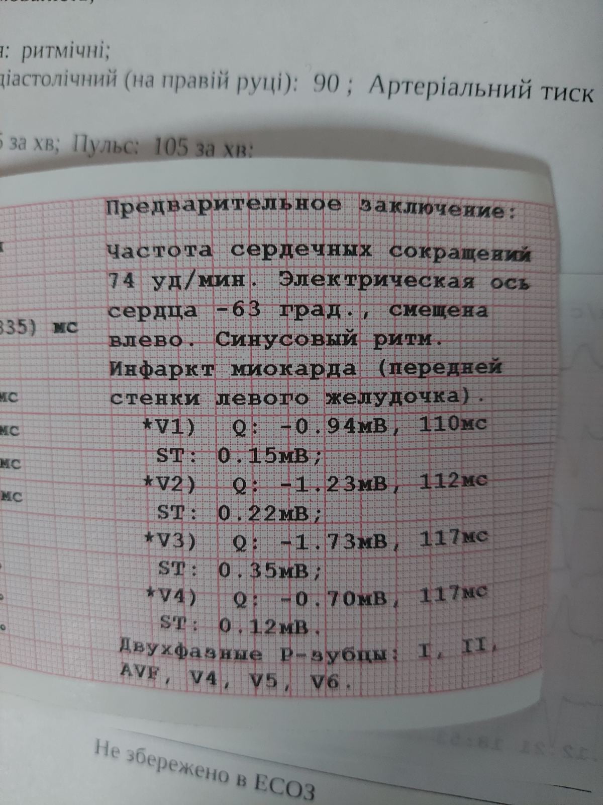 В Киеве охрана "Эпицентра" силой раздела 67-летнюю женщину: у пострадавшей произошел инфаркт