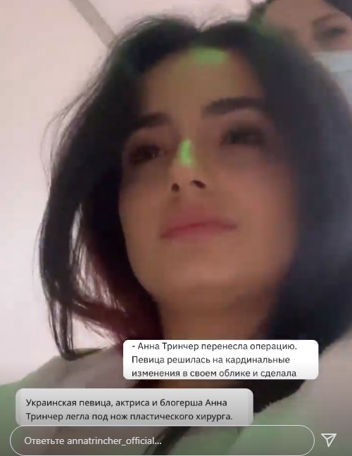Анна Трінчер показала, як виглядала після операції зі збільшення грудей