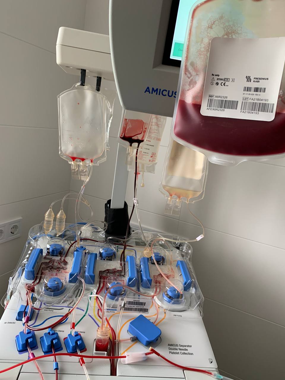 Львовские врачи раскрыли детали первой уникальной операции: &quot;маленький герой совсем не боялся&quot;