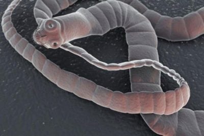 У Черкасах риба заразилася черв'яками: як вберегтися і не з'їсти паразита (фото)