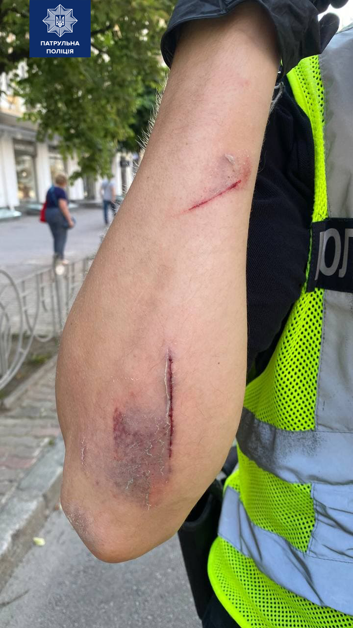 В центре Киева агрессивный водитель специально сбил "копа" из-за перекрытых улиц