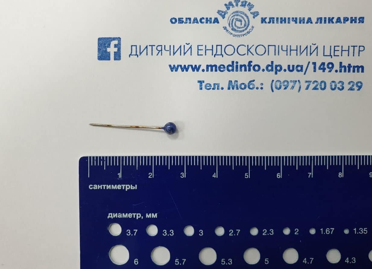 У Дніпрі дитина проковтнула булавку: лікарі врятували незвичайним способом (фото)