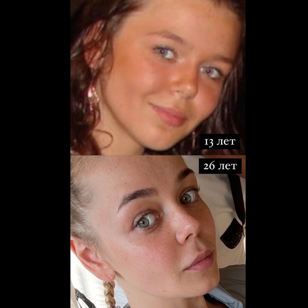 Без макияжа и фотошопа: Алина Гросу показала, как изменилась ее внешность с возрастом