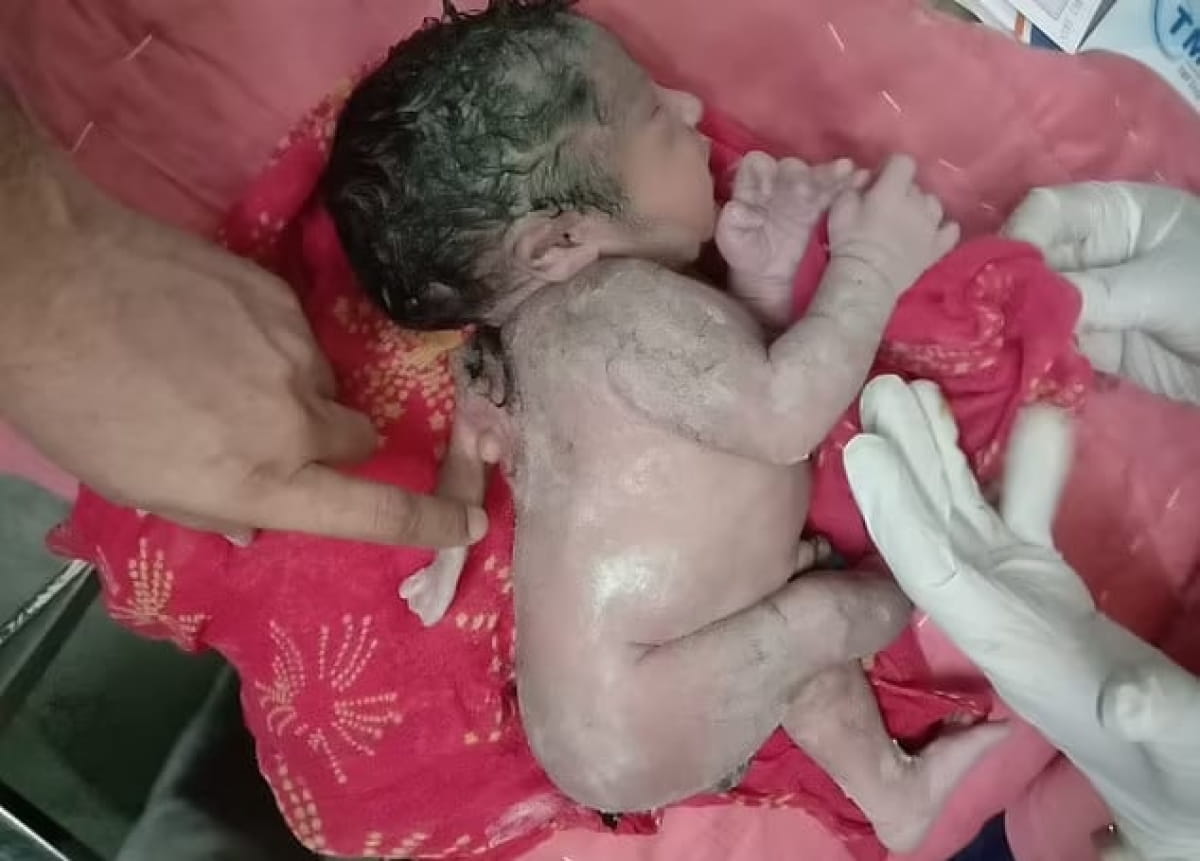 Ребенок родился с третьей рукой в неожиданном месте (фото)