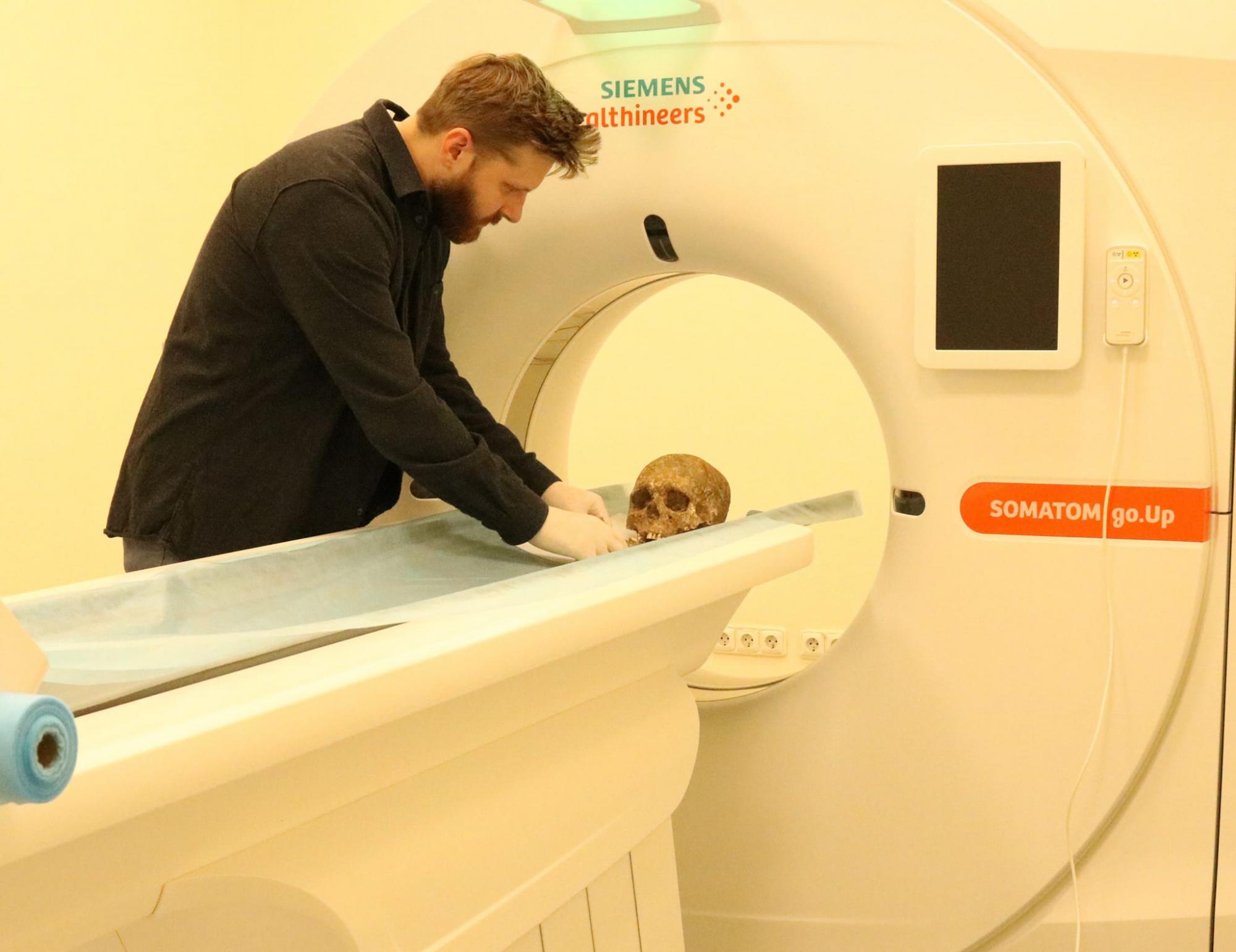 Лежали в могиле, обнявшись: под Тернополем нашли захоронение, возраст которого 3000 лет (фото)