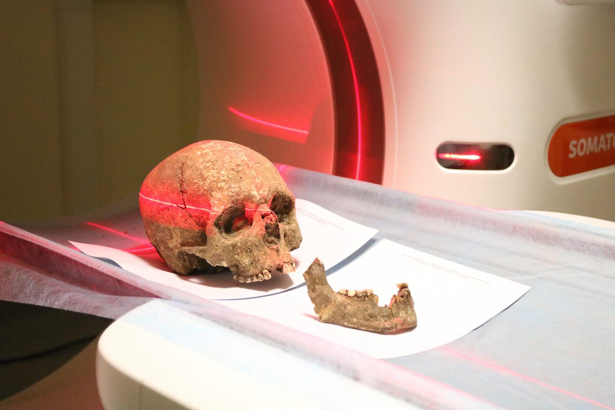 Лежали в могиле, обнявшись: под Тернополем нашли захоронение, возраст которого 3000 лет (фото)