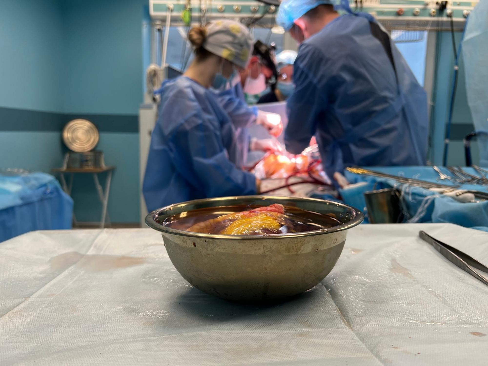 Украинские врачи за шесть дней пересадили семь органов: как прошли операции