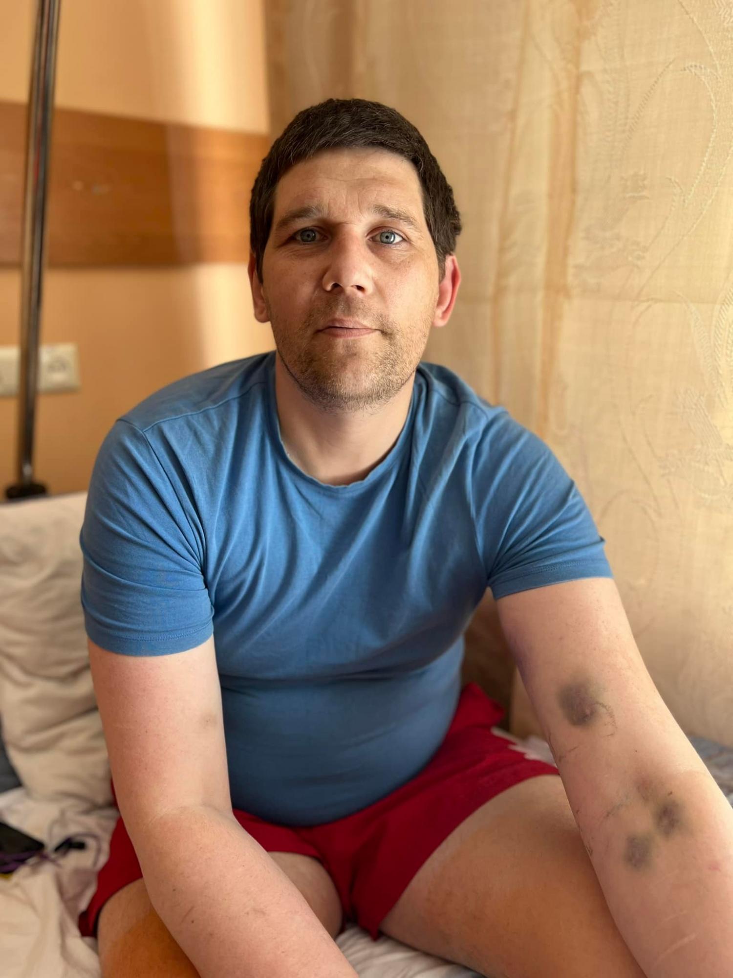 Львовские врачи прооперировали пациента из Славянска, у которого нога сгибалась в разные стороны