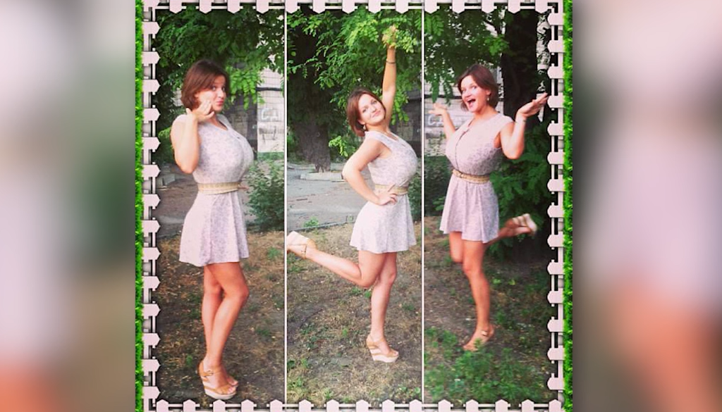 Скільки коштує ринопластика і зменшення грудей: Аліна Доротюк назвала суму