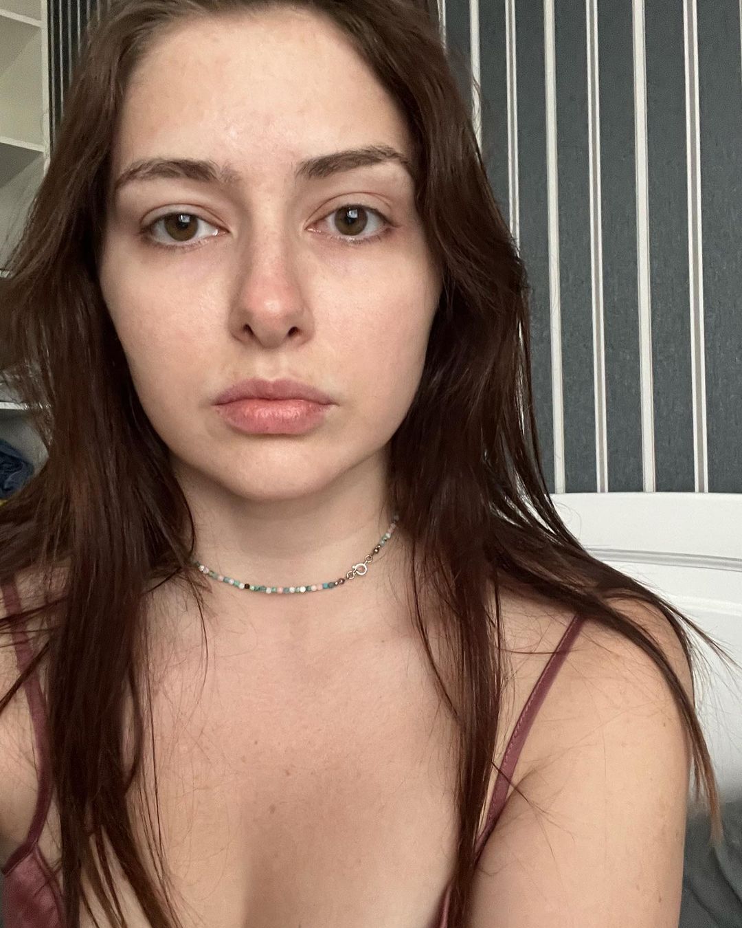 &quot;Вирок один&quot;: важкохвора акторка Тишкевич розповіла про свій діагноз після 8 років хронічного болю