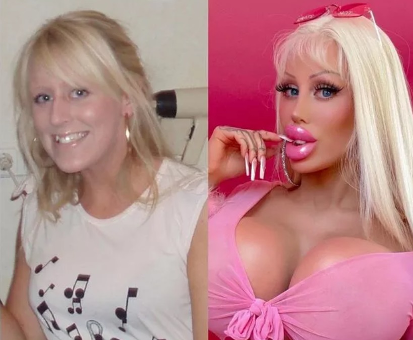 Женщина потратила 120 тыс. долларов, чтобы стать похожей на Барби. Смотрите, как она выглядит