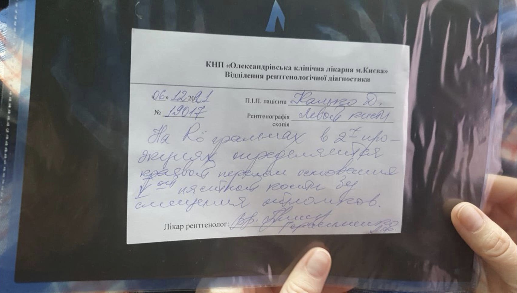 Побив трубою і зламав руку: у Києві охоронець лікарні напав на чоловіка (відео)